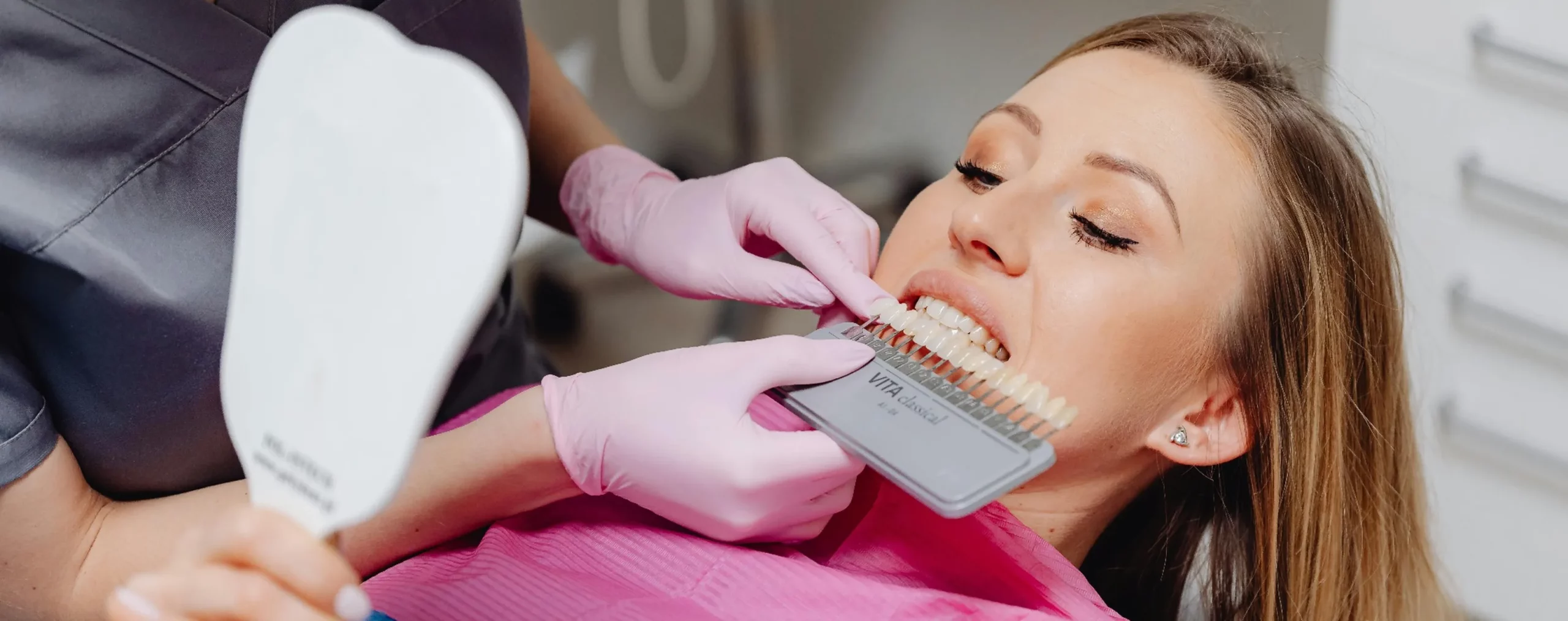 Veneers: Der sanfte Weg zum perfekten Lächeln mit Stil